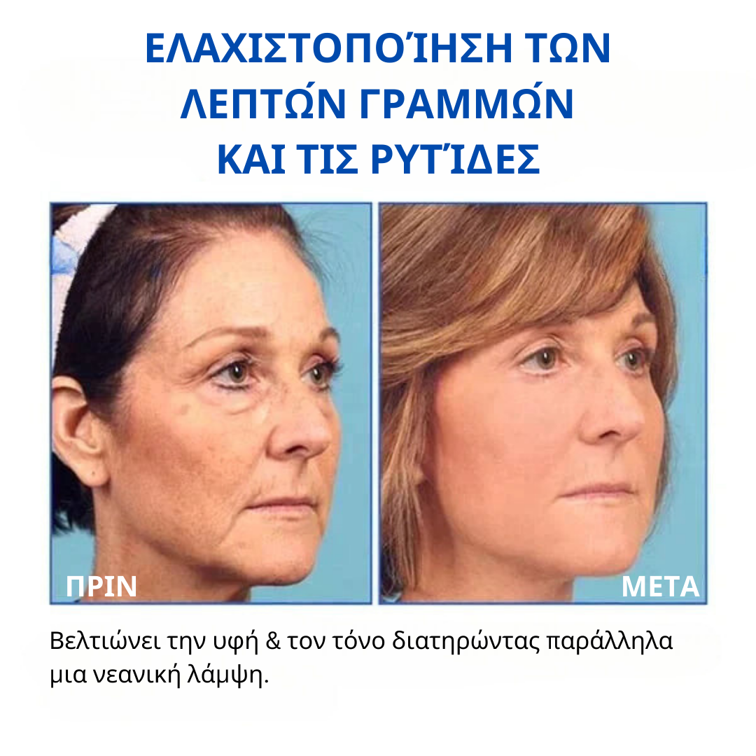 σέρουμ προσώπου με μπότοξ