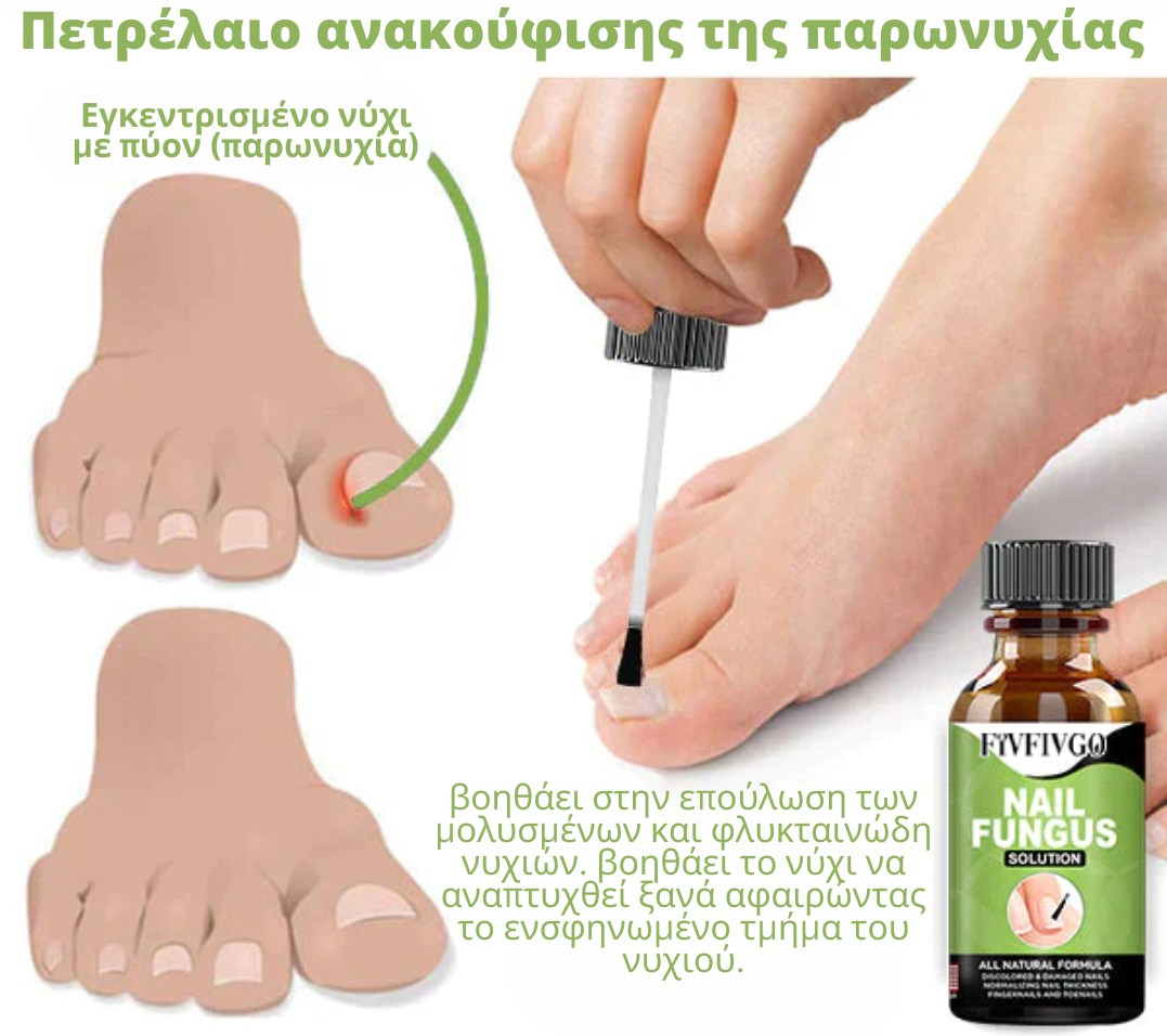 Τζελ αφαίρεσης παρωνυχίας Fivfivgo FootCure