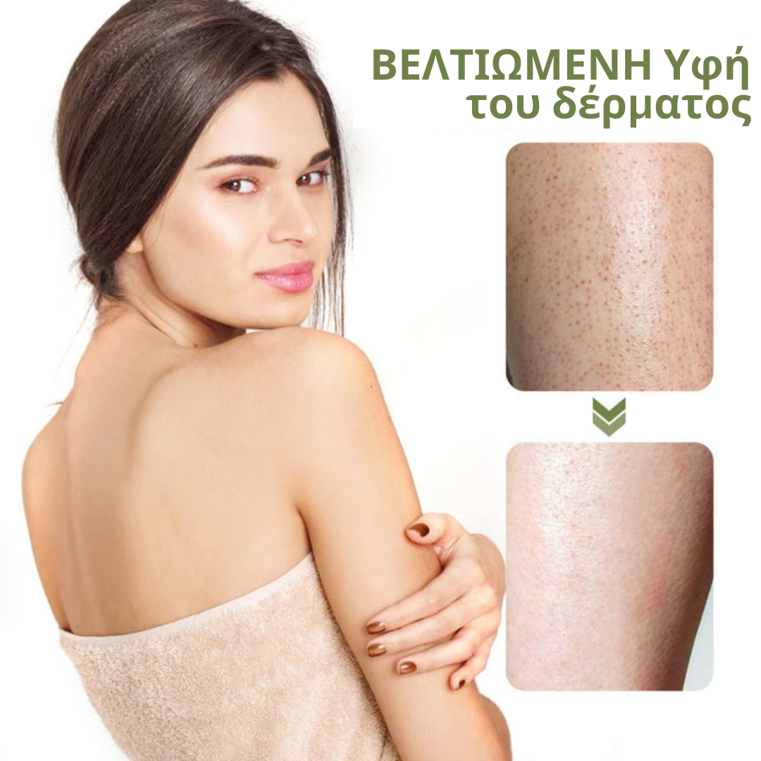 Κρέμα επεξεργασίας Flysmus Keratosis για βαθιά καθαρισμένη και λεία επιδερμίδα