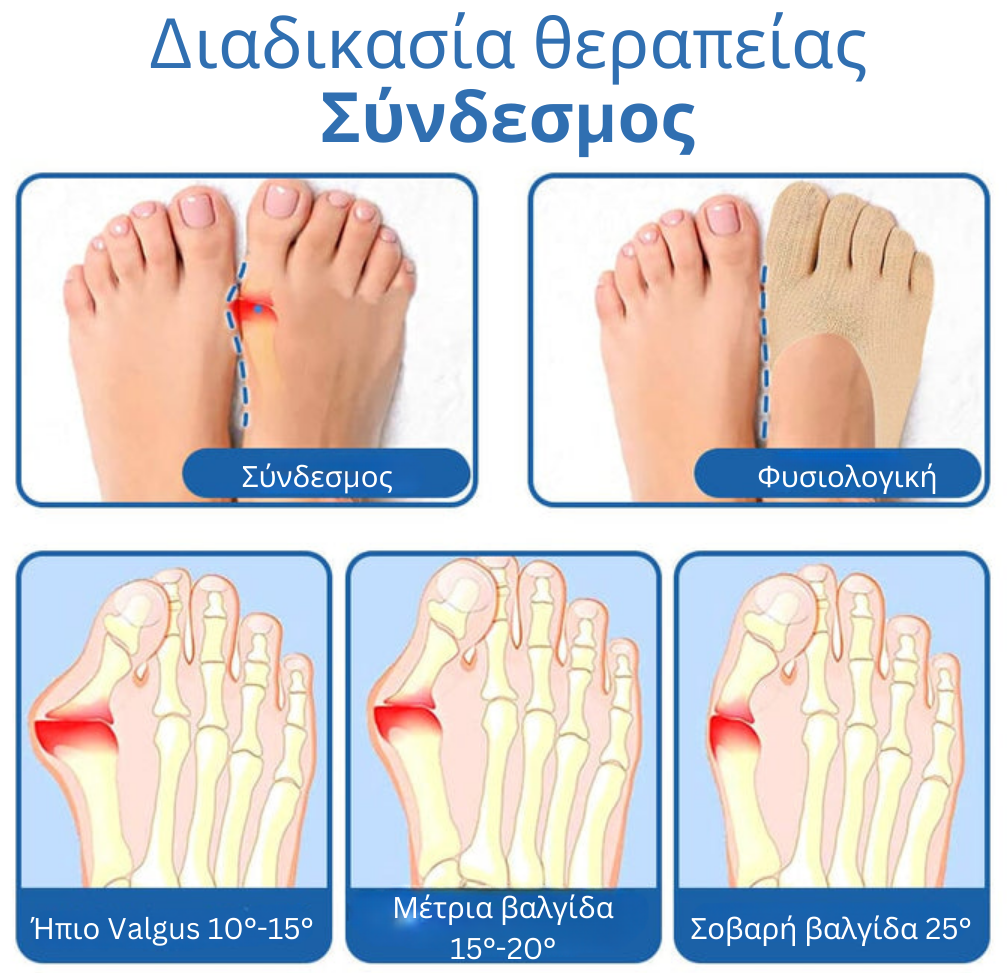 Κάλτσα υγείας Pro αρθρώσεων Anti Bunions