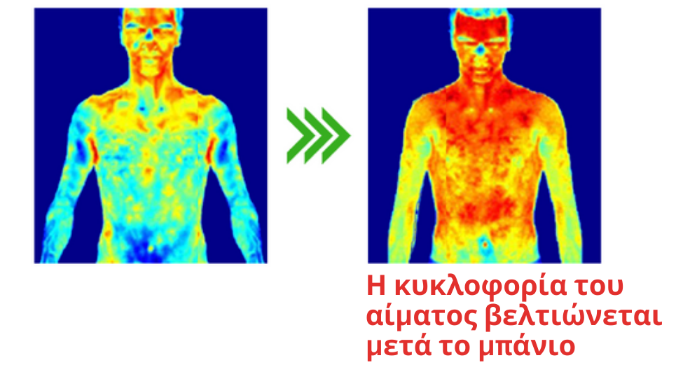 Flysmus Acanthosis Nigricans Treatment Σαπούνι με κάρβουνο μπαμπού