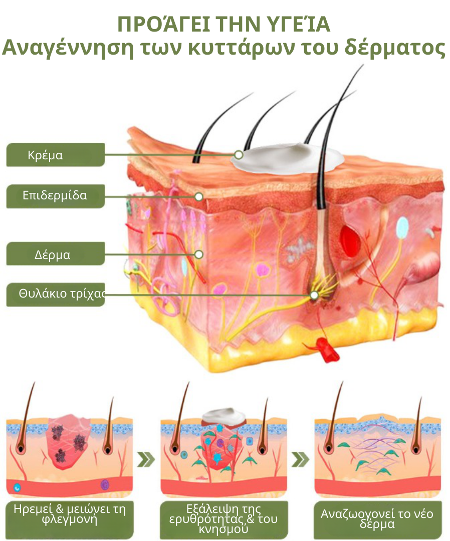 Κρέμα επεξεργασίας Flysmus Keratosis για βαθιά καθαρισμένη και λεία επιδερμίδα