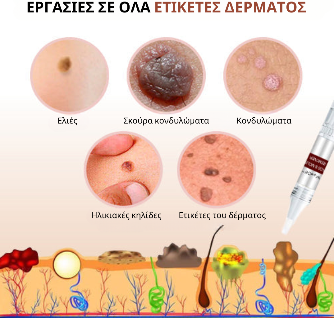 WipeOff Αφαίρεση ετικετών και κρεατοελιών