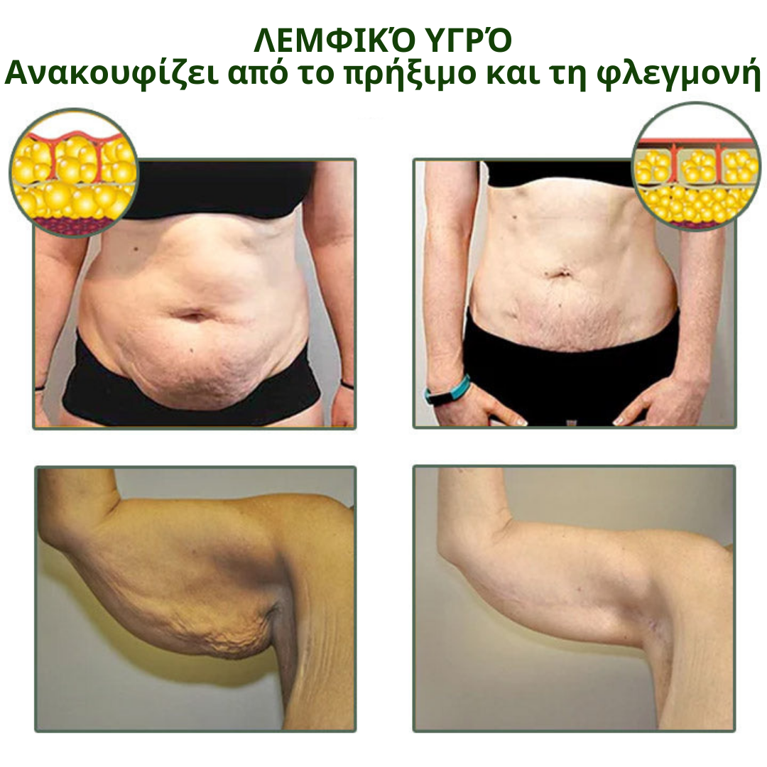 Oveallgo Wormwood Cellulite AwayWith κρέμα σύσφιξης δέρματος