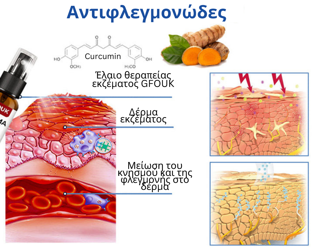 Σπρέι θεραπείας εκζέματος GFOUK