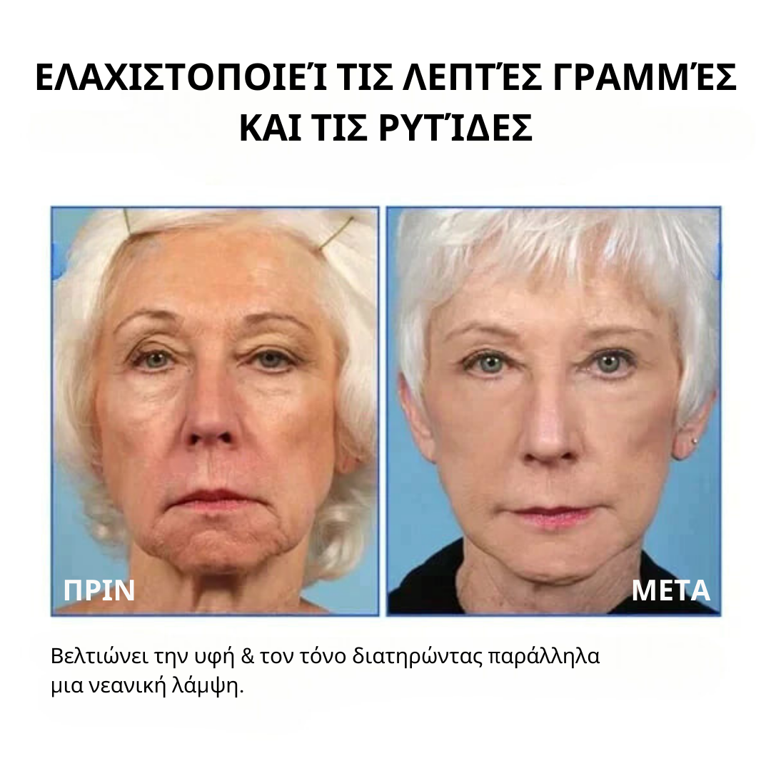 σέρουμ προσώπου με μπότοξ