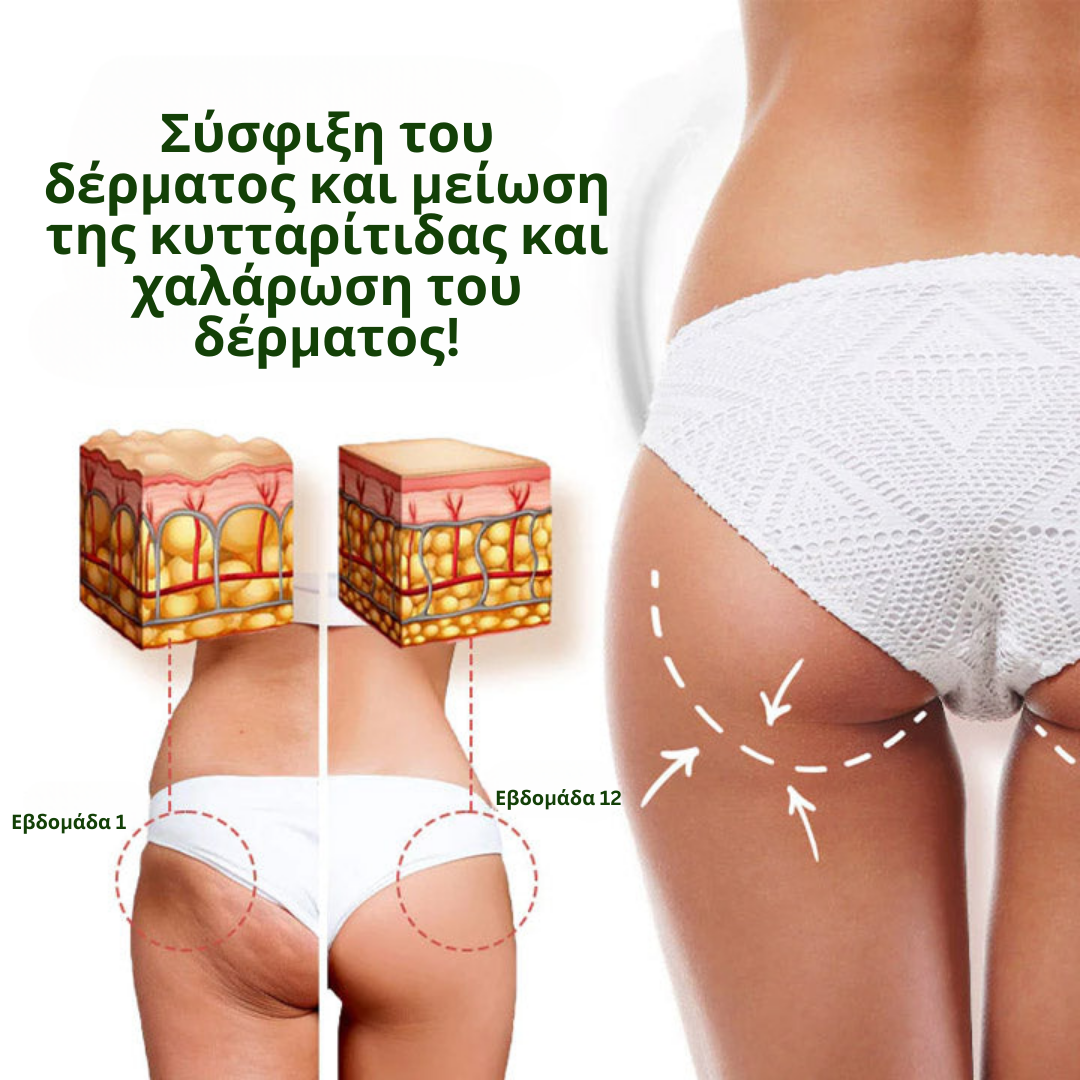 Oveallgo Wormwood Cellulite AwayWith κρέμα σύσφιξης δέρματος **