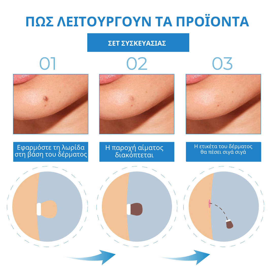 ATTDX Συσκευές Ανώδυνης Αφαίρεσης Θηλών του Δέρματος για Θαύμα Επιδερμίδα