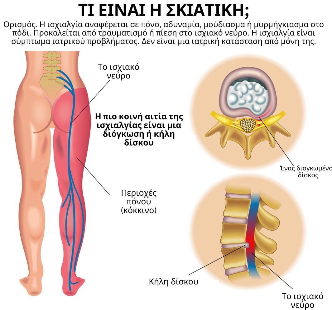 Ricpind Ζώνη Συμπίεσης για Ανακούφιση Πόνου Πλάτης και Ισχίου