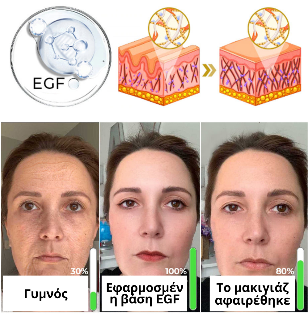 MIRACLE EGF Ορός Βάσης Αντιρυτιδικός Αντιγηραντικός