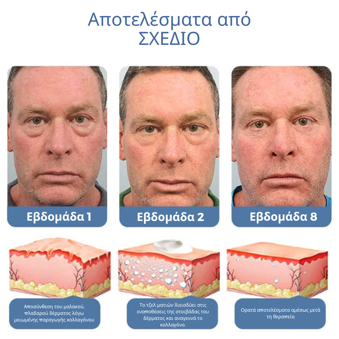 Openeyes Σερουμ Πεπτιδίων Ανύψωσης για τα Μάτια